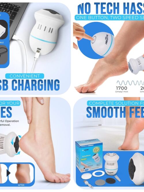 Electric Foot Callus Remover - USB-Rechargeable Electric Callus Remover for Feet with Built-in Vacuum Removes Dead Skin from Feet,